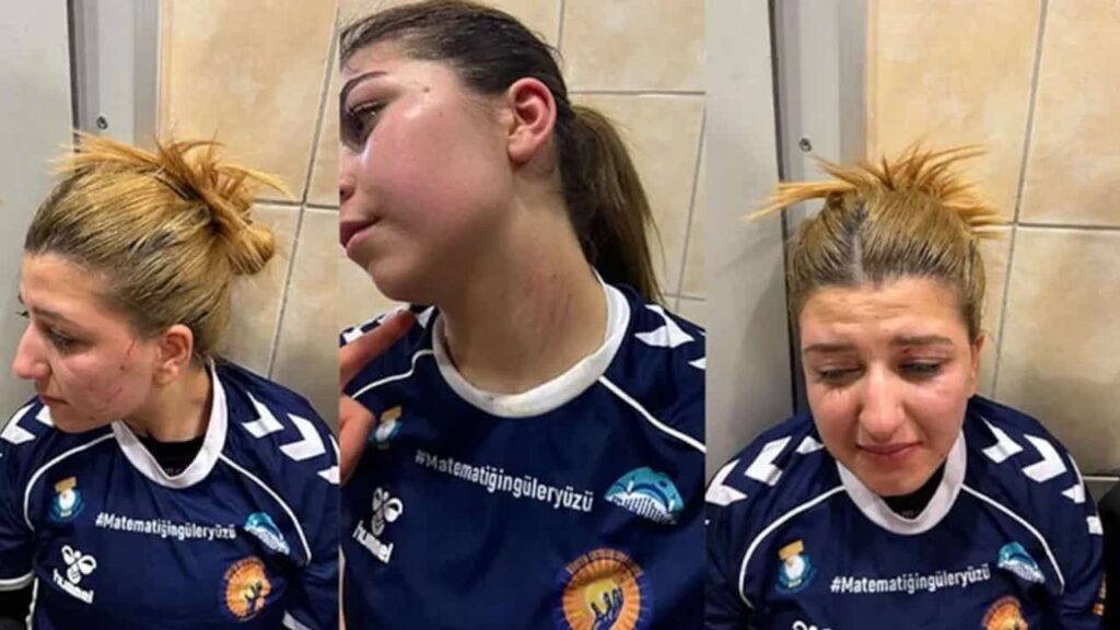 Bingöl'de kadın Hentbol takımı saldırıya uğradı. Türkiye Hentbol Federasyonu Kadınlar 2. Lig G Grubu maçından sonra taraftarlar sahaya girerek sporcuları darp etti. 